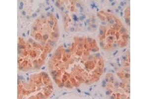 IHC-P analysis of Human Tissue, with DAB staining. (MAN2B1 anticorps  (AA 883-1011))