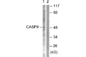 Immunohistochemical analysis of paraffin-embedded human lung carcinoma tissue using Caspase 9 (Ab-125) antibodyWestern blot analysis of extracts from NIH/3T3 cells treated with TNF-α (20ng/ml, 30min), using Caspase 9 (Ab-125) antibody (Caspase 9 anticorps)