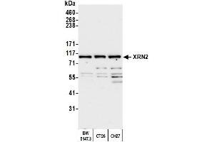 Western Blotting (WB) image for anti-5'-3' Exoribonuclease 2 (XRN2) (AA 900-950) antibody (ABIN7454718) (XRN2 anticorps  (AA 900-950))