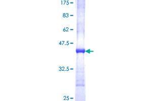 Image no. 1 for Fatty Acid Desaturase 1 (FADS1) (AA 1-99) protein (GST tag) (ABIN1353358)