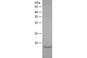 Western Blotting (WB) image for S100 Calcium Binding Protein A10 (S100A10) (AA 1-97) protein (His tag) (ABIN7124946) (S100A10 Protein (AA 1-97) (His tag))