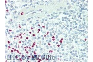 Detection of PADI4 in Human Spleen Tissue using Polyclonal Antibody to Peptidyl Arginine Deiminase Type IV (PADI4)