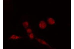 ABIN6274184 staining HeLa cells by IF/ICC. (AFT7 anticorps  (N-Term))