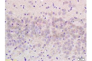 Formalin-fixed and paraffin embedded rat brain labeled with Anti- NCX2/SLC8A2 Polyclonal Antibody, Unconjugated  at 1:200 followed by conjugation to the secondary antibody and DAB staining