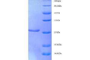 SDS-PAGE (SDS) image for X-Ray Repair Complementing Defective Repair in Chinese Hamster Cells 5 (Double-Strand-Break Rejoining) (XRCC5) (AA 251-455), (partial) protein (His tag) (ABIN5710636)