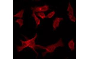 ABIN6277126 staining HuvEc by IF/ICC.