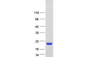 Validation with Western Blot