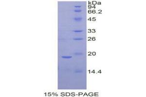 SDS-PAGE analysis of Rat Periostin Protein.