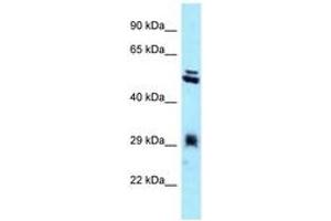 Image no. 1 for anti-Thioredoxin-Related Transmembrane Protein 1 (TMX1) (C-Term) antibody (ABIN6747965) (TMX1 anticorps  (C-Term))