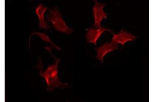 ABIN6275597 staining HeLa by IF/ICC. (SLCO1A2 anticorps  (Internal Region))