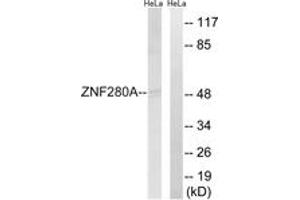 Western blot analysis of extracts from HeLa cells, using ZNF280A Antibody.