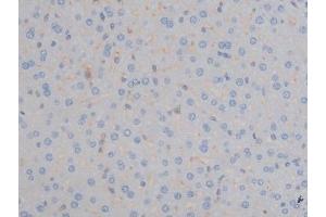 ABIN6267337 at 1/200 staining Mouse liver tissue sections by IHC-P.