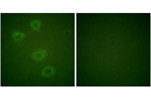 Immunofluorescence analysis of HuvEc cells, using Tyrosine Hydroxylase (Phospho-Ser19) Antibody. (Tyrosine Hydroxylase anticorps  (pSer18))