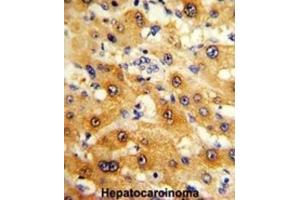 Immunohistochemistry (IHC) image for anti-Ribosomal Protein S15 (RPS15) antibody (ABIN3002876)