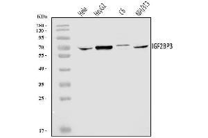 Western blot analysis of IMP3/IGF2BP3 using anti-IMP3/IGF2BP3 antibody (ABIN7602494).
