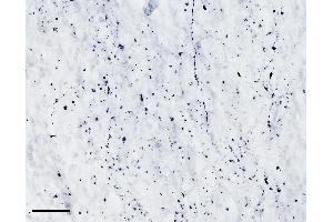 (ABIN768607) (scale bar: 50 μm) immunostaining of TPH2 processes in cryosection of the infundibular nucleus of an immersion-fixed (4 % PFA) human hypothalamus. (Tryptophan Hydroxylase 2 anticorps  (AA 16-29))