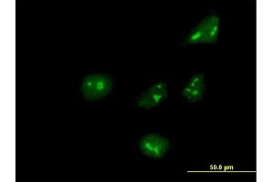 Immunofluorescence of purified MaxPab antibody to ARHGEF10 on HeLa cell. (ARHGEF10 anticorps  (AA 1-380))