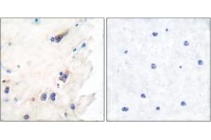 Immunohistochemistry analysis of paraffin-embedded human brain tissue, using PLCB3 (Ab-1105) Antibody.
