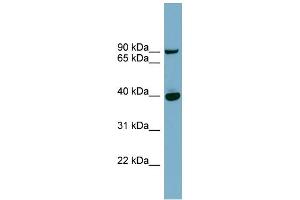 WB Suggested Anti-PNPLA8 Antibody Titration: 0. (PNPLA8 anticorps  (Middle Region))