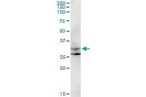 CENPP monoclonal antibody (M07), clone 3G8. (CENPP anticorps  (AA 1-98))