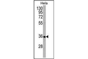 Western blot analysis using ATG5 Antibody (N-term) in Hela cell line lysates (35ug/lane).