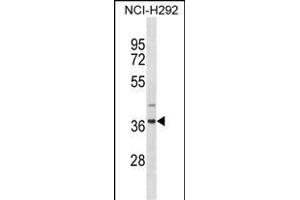 ZN Antibody (N-term) (ABIN1882033 and ABIN2838649) western blot analysis in NCI- cell line lysates (35 μg/lane). (ZNF696 anticorps  (N-Term))