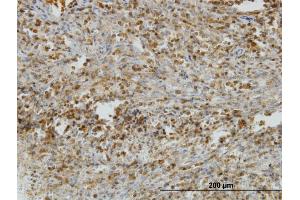 Immunoperoxidase of monoclonal antibody to IL31RA on formalin-fixed paraffin-embedded human spleen.