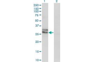 Western Blot analysis of EDN3 expression in transfected 293T cell line by EDN3 monoclonal antibody (M01), clone 2A6-2A4. (Endothelin 3 anticorps  (AA 1-238))