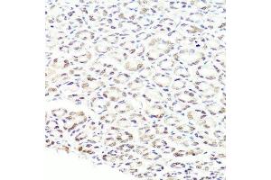 Immunohistochemistry of paraffin-embedded mouse stomach using PRPF8 antibody. (PRPF8 anticorps  (AA 1-100))