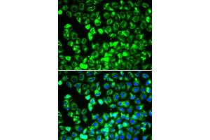 Immunofluorescence analysis of HeLa cells using DLD antibody. (DLD anticorps  (AA 36-300))