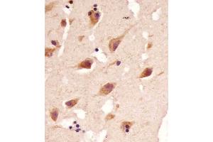 (ABIN392371 and ABIN2842007) staining TBK1 in human brain tissue sections by Immunohistochemistry (IHC-P - paraformaldehyde-fixed, paraffin-embedded sections).