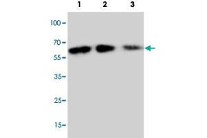 Western blot analysis of rbinate mouse Cx3cl1 protein with Cx3cl1 polyclonal antibody . (CX3CL1 anticorps  (N-Term))