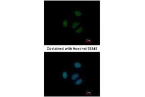 ICC/IF Image Immunofluorescence analysis of paraformaldehyde-fixed MCF-7, using RPS15, antibody at 1:500 dilution.