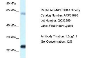 Western Blotting (WB) image for anti-NADH Dehydrogenase (Ubiquinone) Fe-S Protein 8, 23kDa (NADH-Coenzyme Q Reductase) (NDUFS8) (C-Term) antibody (ABIN2788918) (NDUFS8 anticorps  (C-Term))