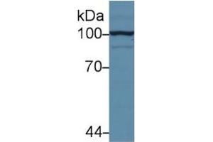 Rabbit Capture antibody from the kit in WB with Positive Control: Sample Human hela cell lysate.
