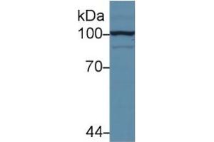 Rabbit Capture antibody from the kit in WB with Positive Control: Sample Human hela cell lysate. (Hexokinase 2 Kit ELISA)