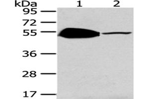 Western Blotting (WB) image for anti-TSPY-Like 1 (TSPYL1) antibody (ABIN5962132) (TSPYL1 anticorps)