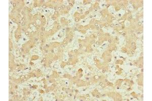 Immunohistochemistry of paraffin-embedded human liver tissue using ABIN7157665 at dilution of 1:100