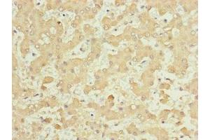 Immunohistochemistry of paraffin-embedded human liver tissue using ABIN7157665 at dilution of 1:100 (NUF2 anticorps  (AA 165-464))