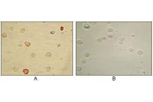 Immunocytochemistry analysis of TPA induced BCBL-1 cells (A) and uninduced BCBL-1 cells (B) using KSHV ORF45 mouse mAb with AEC staining. (KSHVORF45 anticorps)