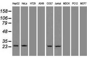 Western blot analysis of 35 µg of cell extracts from human brain tissue lysates using anti-NEUROG1 antibody. (Neurogenin 1 anticorps)
