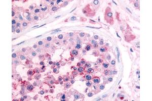 Anti-PDE3A antibody IHC of human testis. (PDE3A anticorps  (N-Term))