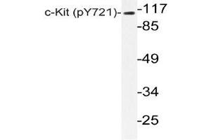 Western blot (WB) analyzes of p-c-Kit (pTyr721) antibody in extracts from HepG2 EGF cells. (KIT anticorps  (pTyr721))