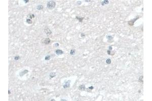 Detection of BANF1 in Human Cerebrum Tissue using Polyclonal Antibody to Barrier To Autointegration Factor 1 (BANF1)