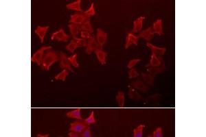 Immunofluorescence analysis of A549 cells using LECT1 Polyclonal Antibody (LECT1 anticorps)