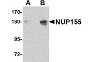 Western Blotting (WB) image for anti-Nucleoporin 155kDa (NUP155) (C-Term) antibody (ABIN1030553) (NUP155 anticorps  (C-Term))