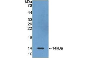 Detection of Recombinant bTG, Human using Polyclonal Antibody to Chemokine (C-X-C motif) ligand 7 ( CXCL7) (CXCL7 anticorps  (AA 59-128))