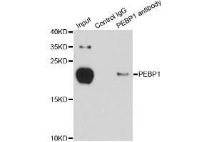 Immunoprecipitation analysis of 150ug extracts of MCF-7 cells using 3ug PEBP1 antibody. (PEBP1 anticorps)