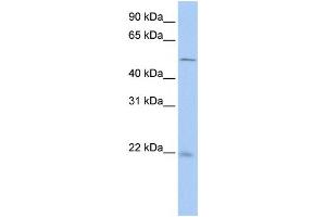 Western Blotting (WB) image for anti-Syndecan Binding Protein (Syntenin) 2 (SDCBP2) antibody (ABIN2459879) (SDCBP2 anticorps)