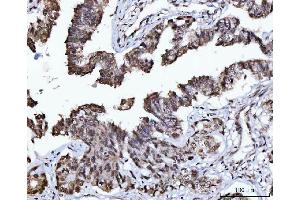 IHC analysis of USP26 using anti-USP26 antibody (ABIN7599543). (USP26 anticorps  (AA 1-762))